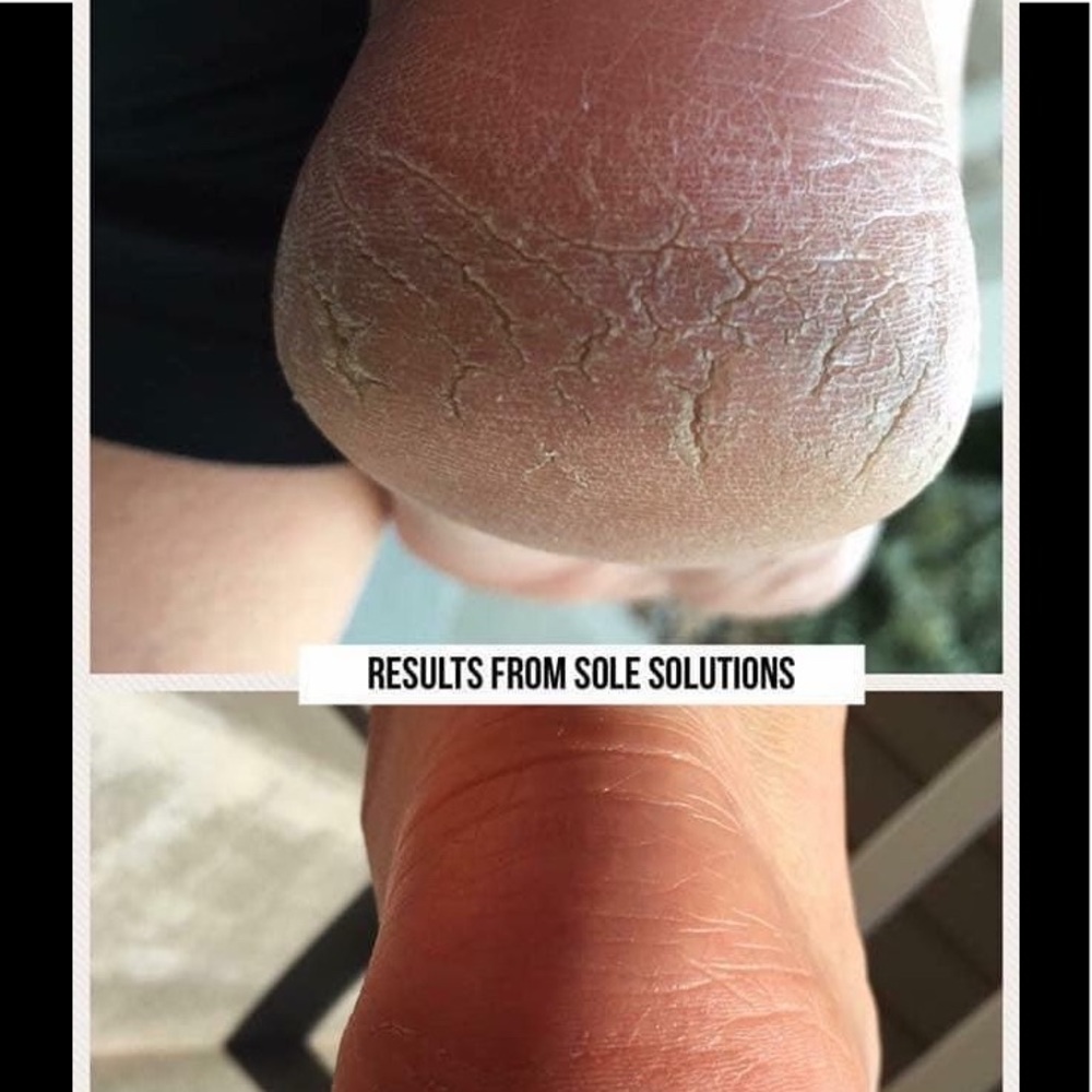 Epoch Sole Solution